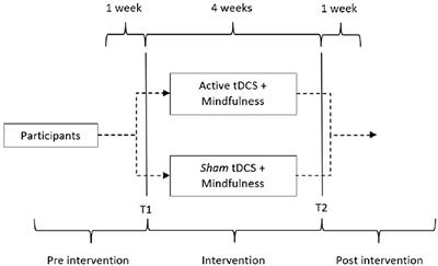 Effects of Synergism of Mindfulness Practice Associated With Transcranial Direct-Current Stimulation in Chronic Migraine: Pilot, Randomized, Controlled, Double-Blind Clinical Trial
